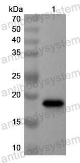 Anti-Human SLC16A2 Polyclonal Antibody