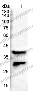 Anti-CHI3L1 Polyclonal Antibody