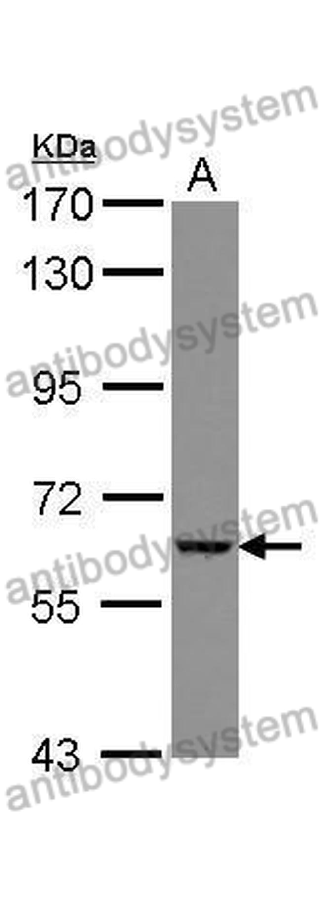 Anti-GGT5 Polyclonal Antibody