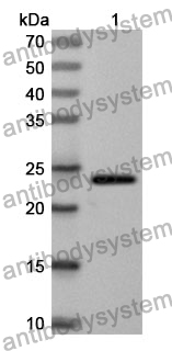 Anti-GGT5 Polyclonal Antibody