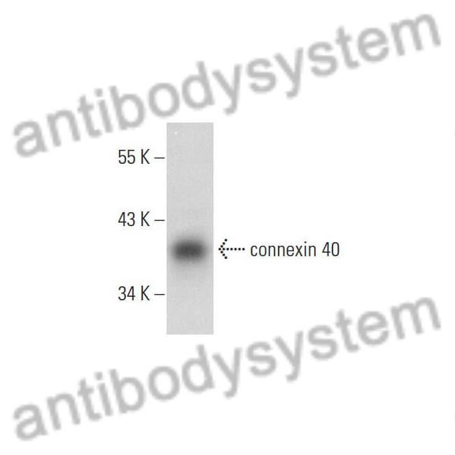 Anti-GJA5 Polyclonal Antibody