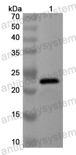 Anti-Human TCF7 Polyclonal Antibody