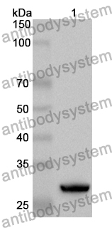 Anti-Human ATP6V1E1 Polyclonal Antibody