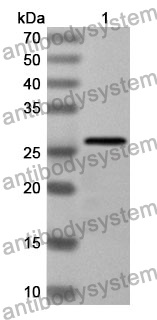 Anti-PGM1 Polyclonal Antibody