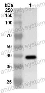 Anti-Human PPP1CC Polyclonal Antibody