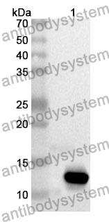 Anti-ACVR1B Polyclonal Antibody