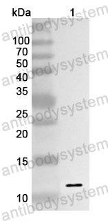 Anti-TGFBR1 Polyclonal Antibody