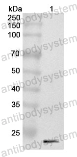 Anti-LTBR Polyclonal Antibody