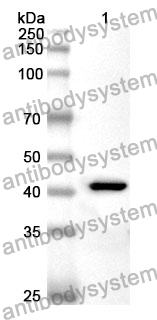 Anti-GPX4 Polyclonal Antibody