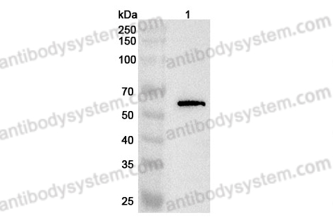 Anti-ACVRL1/ALK-1 Polyclonal Antibody