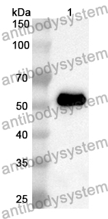 Anti-SCNN1A Polyclonal Antibody