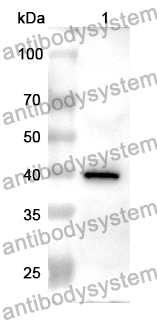 Anti-Human TGFBR2/TGFR-2 Polyclonal Antibody