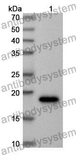 Anti-FDFT1 Polyclonal Antibody