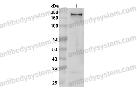 Anti-Human ZEB1 Polyclonal Antibody