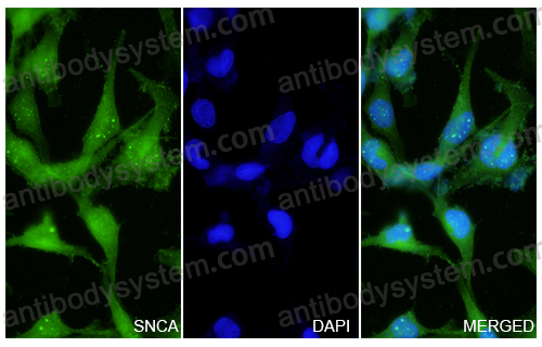 Anti-SNCA Polyclonal Antibody