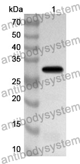 Anti-ETFB Polyclonal Antibody