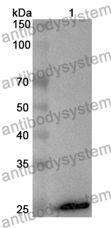 Anti-Human IFNGR2 Polyclonal Antibody