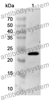 Anti-Human CD103/ITGAE Polyclonal Antibody