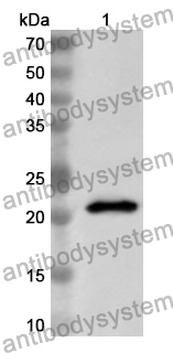 Anti-Human ATP6V1A Polyclonal Antibody