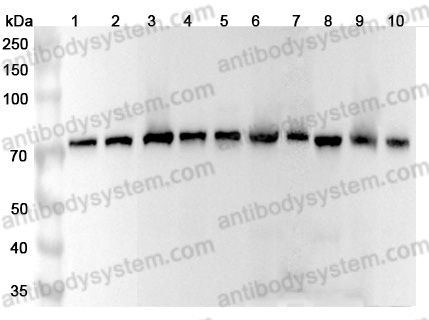 Anti-HSPA9 Polyclonal Antibody