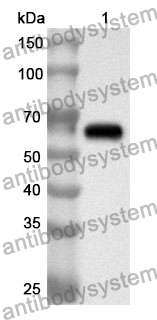 Anti-HSPA9/Mortalin/GRP75 Polyclonal Antibody