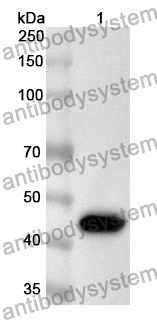 Anti-Human EIF4A3/DDX48 Polyclonal Antibody