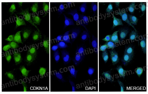 Anti-p21/CDKN1A Polyclonal Antibody