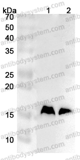 Anti-Human RPS19 Polyclonal Antibody