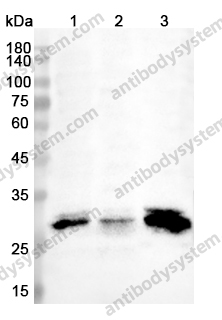 Anti-ANP32A Polyclonal Antibody