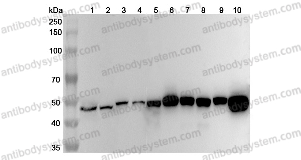 Anti-Human FEN1 Polyclonal Antibody