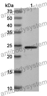 Anti-MMP12 Polyclonal Antibody