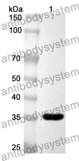 Anti-Human ADCY8 Polyclonal Antibody