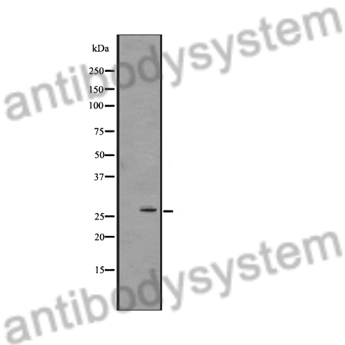 Anti-CD66d/CEACAM3 Polyclonal Antibody