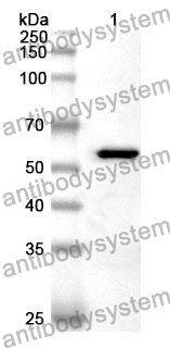 Anti-THPO Polyclonal Antibody