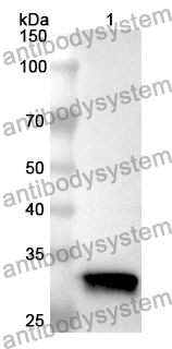 Anti-NNMT Polyclonal Antibody