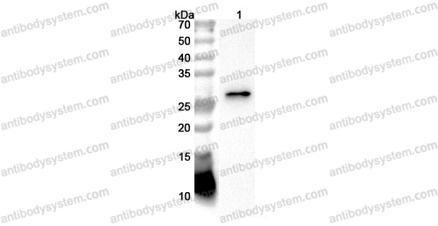 Anti-Human CTRL Polyclonal Antibody