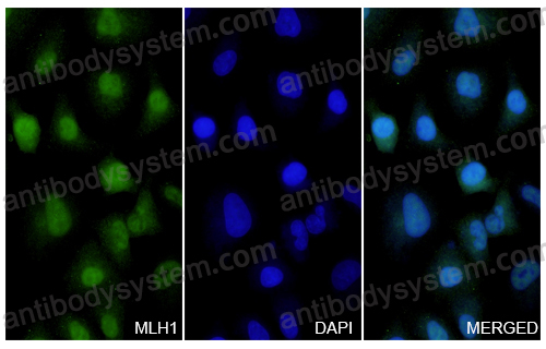 Anti-MLH1 Polyclonal Antibody