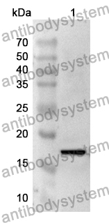 Anti-Human USP8 Polyclonal Antibody