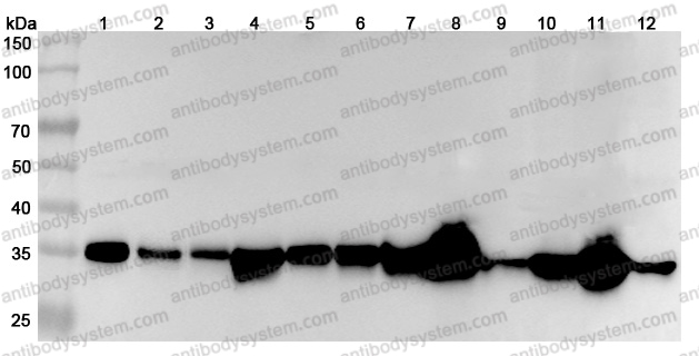 Anti-Human MDH2 Polyclonal Antibody