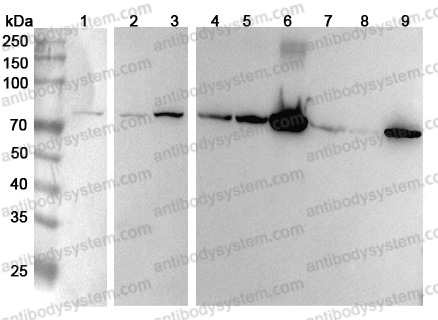 Anti-Human HADHA Polyclonal Antibody