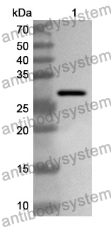 Anti-Human PMEL Polyclonal Antibody