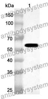 Anti-Human CASR Polyclonal Antibody