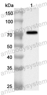 Anti-BCL6 Polyclonal Antibody