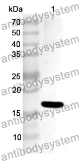 Anti-Human EIF2D Polyclonal Antibody