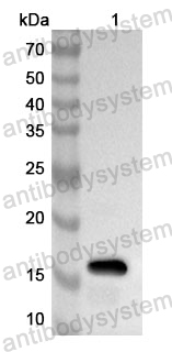 Anti-Human RGS2 Polyclonal Antibody