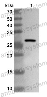 Anti-Human KDM5C Polyclonal Antibody