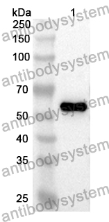 Anti-IARS1 Polyclonal Antibody