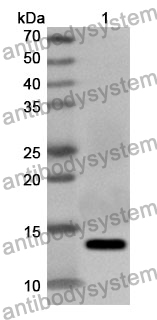 Anti-CD231/TSPAN7 Polyclonal Antibody