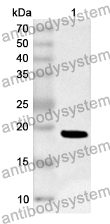 Anti-Human ECI1 Polyclonal Antibody