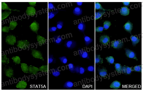 Anti-STAT5A Polyclonal Antibody